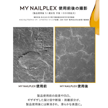 TITANAIL MY NAILPLEX(マイネイルプレックス)